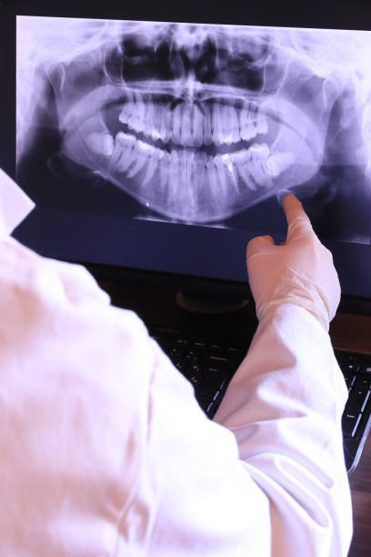Best Emergency Care for Gum Disease in San Mateo, CA