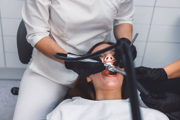 Best Knocked-Out Tooth (Avulsed Tooth) Treatment in San Mateo, CA